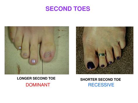 Is long second toe dominant or recessive?