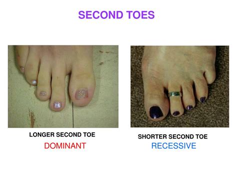 Is longer second toe dominant?