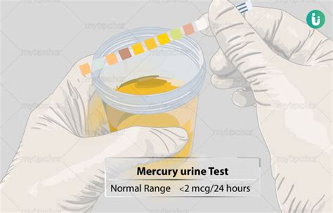 Is mercury tested in blood or urine?