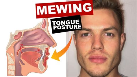 Is mewing meant to hurt?