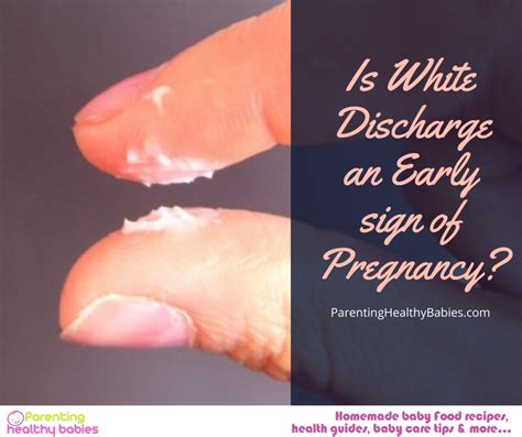 Is milky white discharge OK?