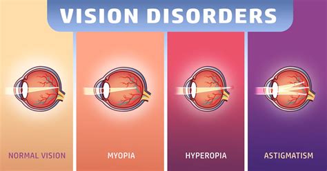 Is minus 1.0 eyesight bad?