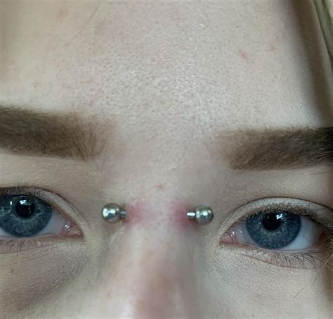 Is my piercing infected or just irritated?