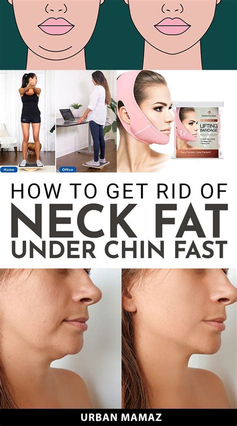 Is neck fat the first to go?