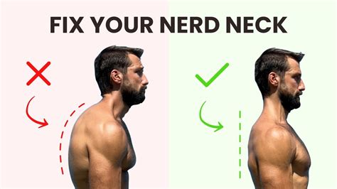 Is nerd neck attractive?