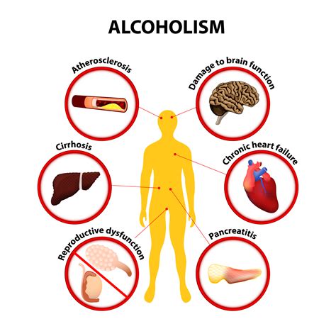 Is no alcohol the healthiest?