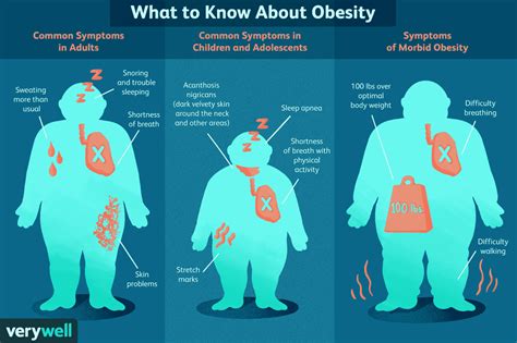 Is obesity a wicked problem?