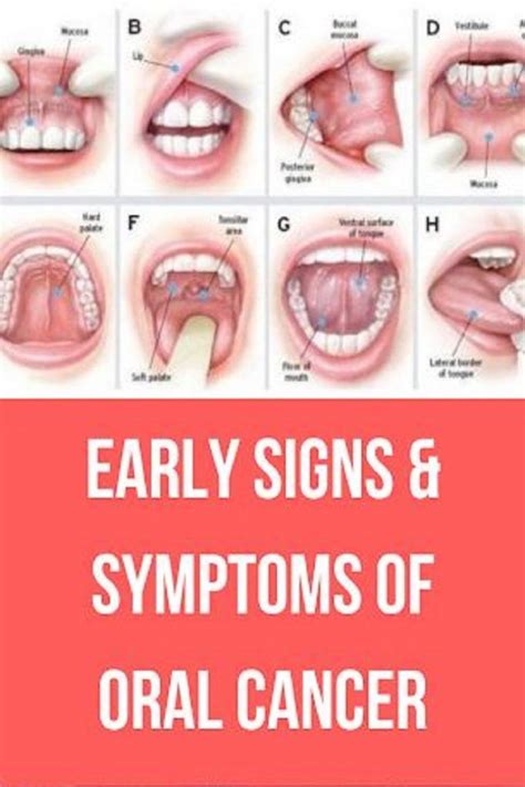 Is oral cancer fast or slow growing?