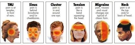 Is pain behind the eye serious?