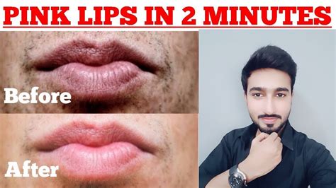 Is pink lips attractive on guys?