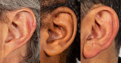 Is playing by ear genetic?