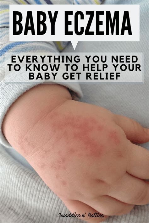 Is polyester bad for babies with eczema?