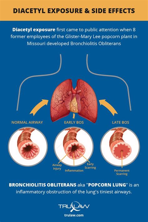 Is popcorn lung caused by diacetyl?