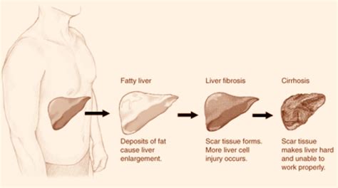 Is protein hard on the liver?