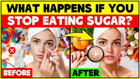 Is quitting sugar good for hair?