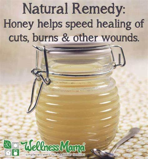 Is raw honey good for burns?