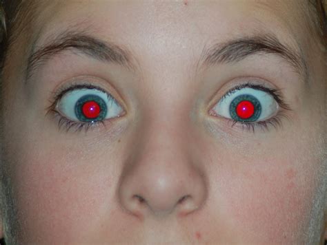 Is red eye harmless?