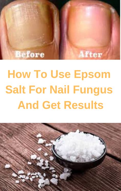 Is salt good for your nails?