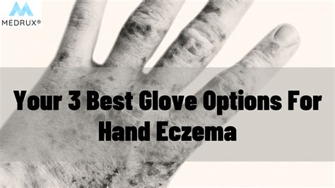 Is satin good for eczema?
