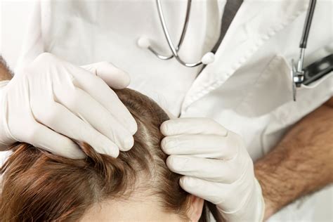 Is scalp fungus painful?