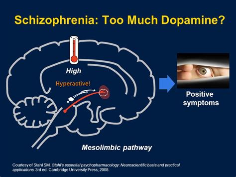Is schizophrenia too much dopamine?