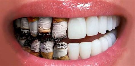Is smoking bad for your lips?