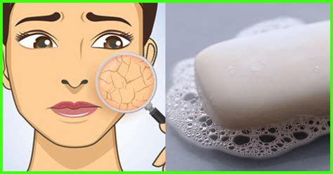 Is soap bad for the face?