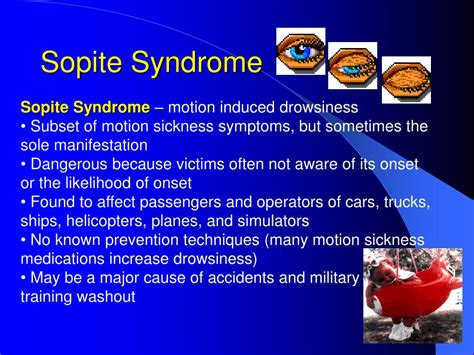 Is sopite syndrome real?