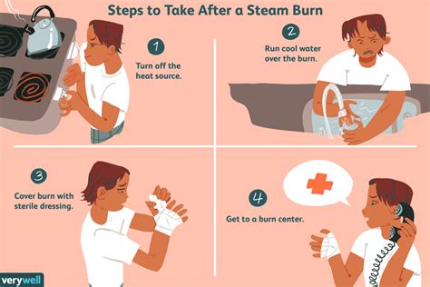 Is steam burn better than water burn?