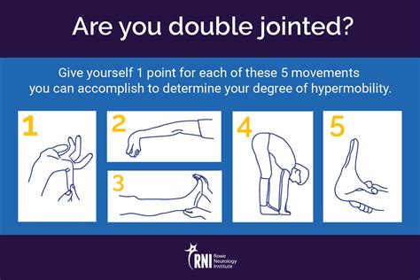 Is stretching bad for hypermobility?