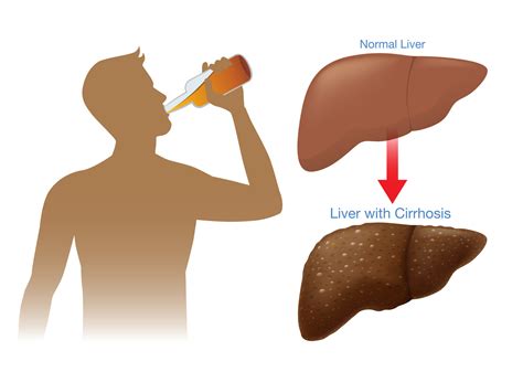 Is sugar harder on your liver than alcohol?