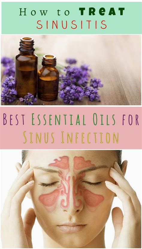 Is sunlight good for sinus?