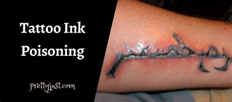 Is tattoo ink toxic?