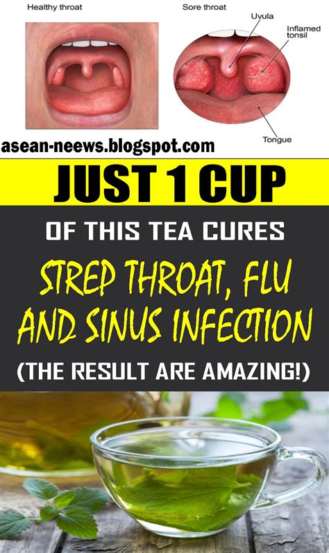 Is tea good for sinus?