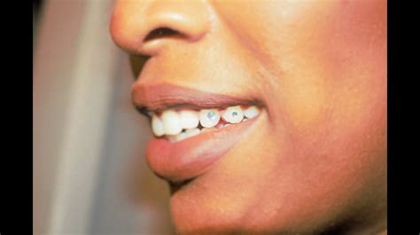 Is teeth jewelry safe?