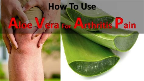 Is the aloe vera plant good for arthritis?