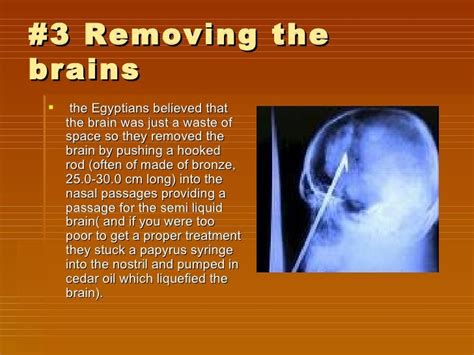 Is the brain removed during embalming?