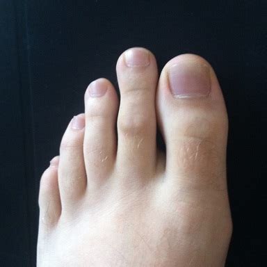 Is the second toe longer than the big toe athletic?