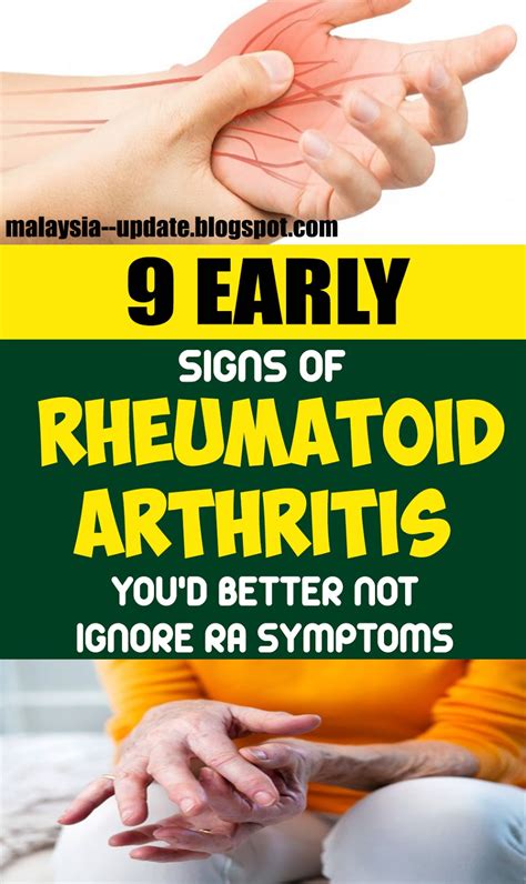 Is the sun good for rheumatoid arthritis?