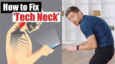 Is there a way to reverse tech neck?