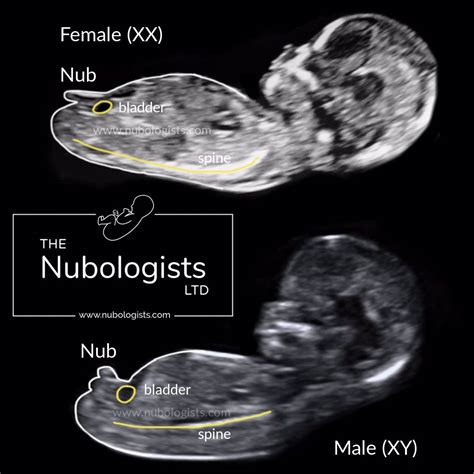 Is there any science behind the nub theory?