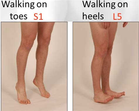 Is toe walking permanent?