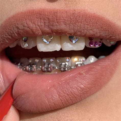 Is tooth gems haram?