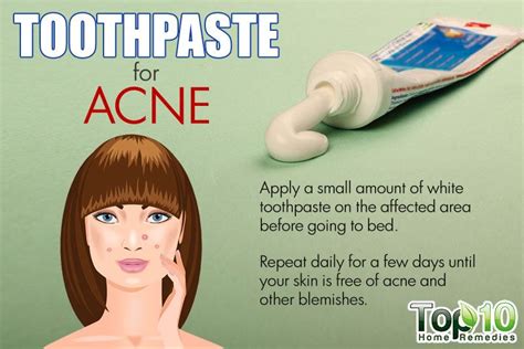 Is toothpaste good for pimples overnight?