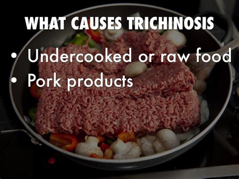 Is trichinosis killed by cooking?
