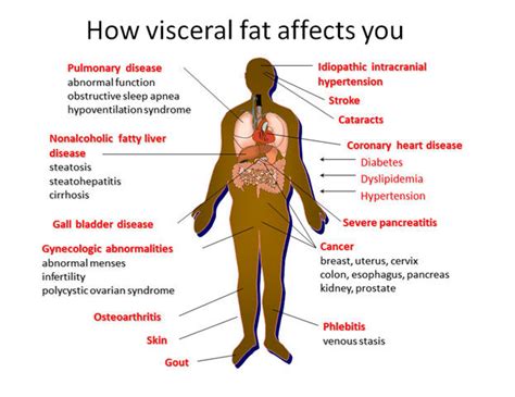 Is visceral fat 8 high?