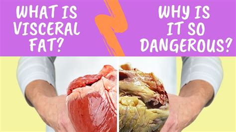 Is visceral fat hard to the touch?