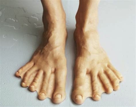 Is webbed feet rare?
