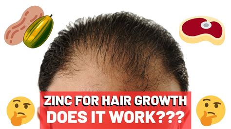 Is zinc good for thinning hair?