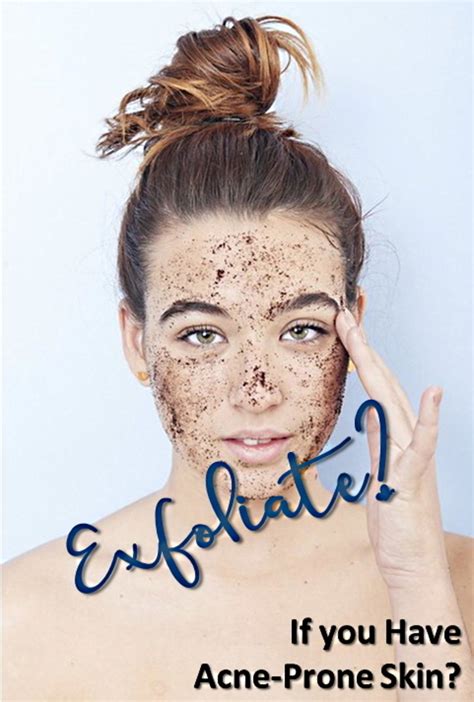 Should I exfoliate even if I have acne?